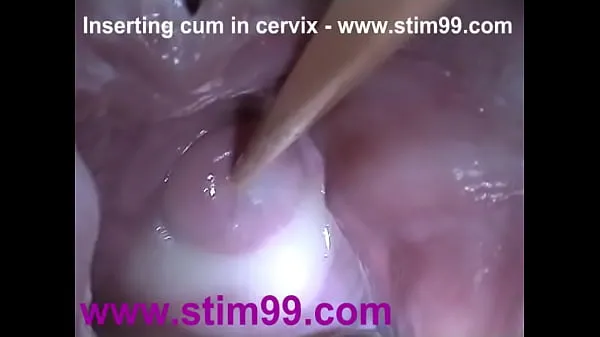 显示Insertion Semen Cum in Cervix Wide Stretching Pussy Speculum驱动器电影