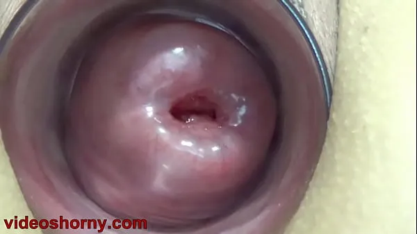 Show Uterus Penetration with Objects, Pumping Cervix Prolapse drive Movies