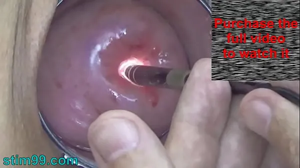 显示Endoscope Camera inside Cervix Cam into Pussy Uterus驱动器电影