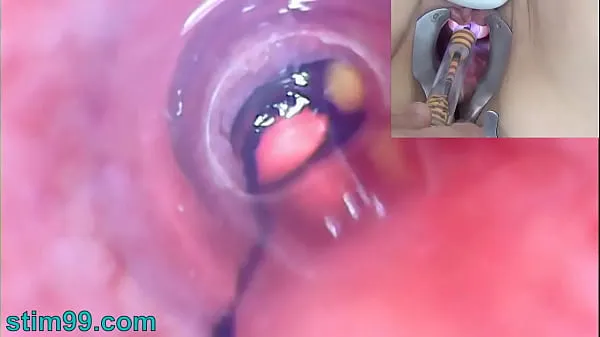 Vis Mature Woman Peehole Endoscope Camera in Bladder with Balls drive-filmer