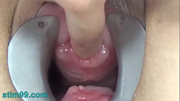 Vis Female Endoscope Camera in Pee Hole with Semen and Sounding with Dildo drev-film