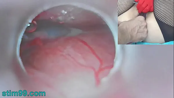 Vis Uncensored Japanese Insemination with Cum into Uterus and Endoscope Camera by Cervix to watch inside womb drive-filmer
